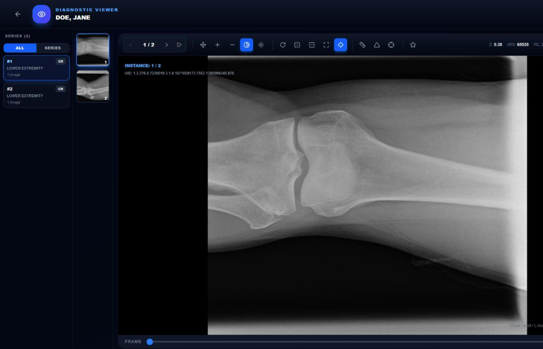 Orion PACS diagnostic viewer showing a wrist study for a synthetic demo patient, with the series thumbnail rail and zoom/pan/window-level tools